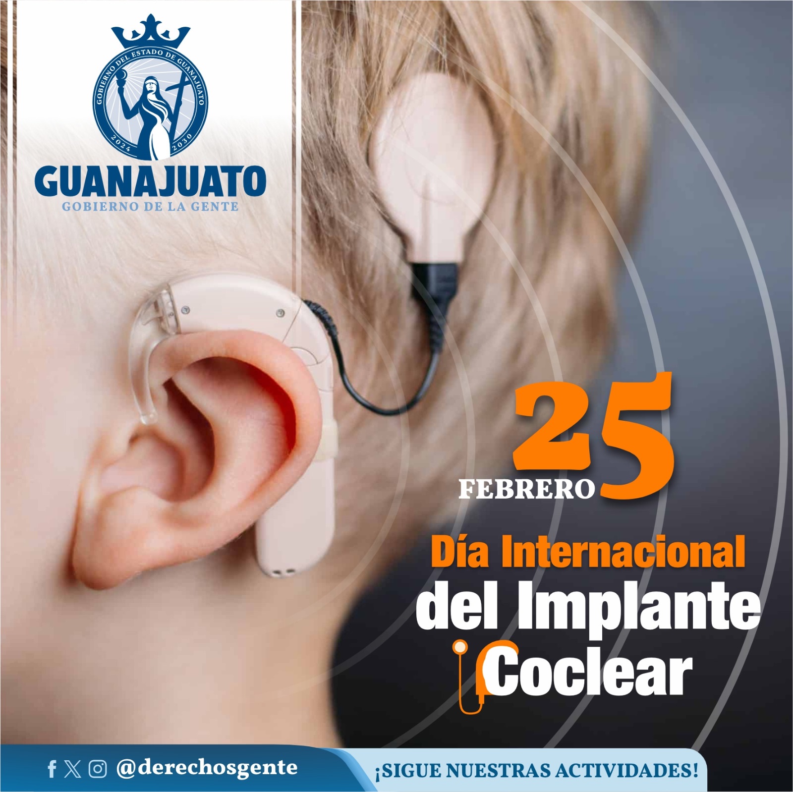 Día Internacional del Implante Coclear