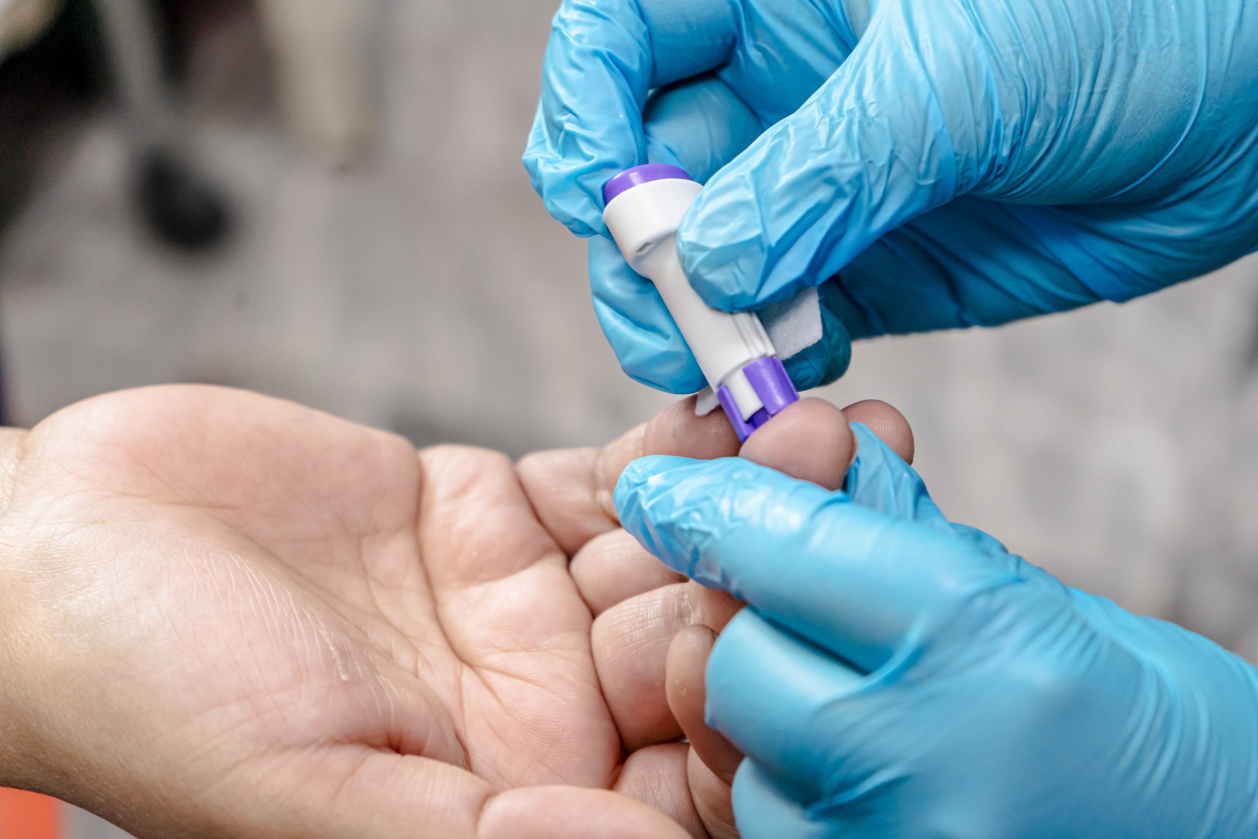 SSG aumentan las pruebas de detección del VIH en la región de Salamanca.