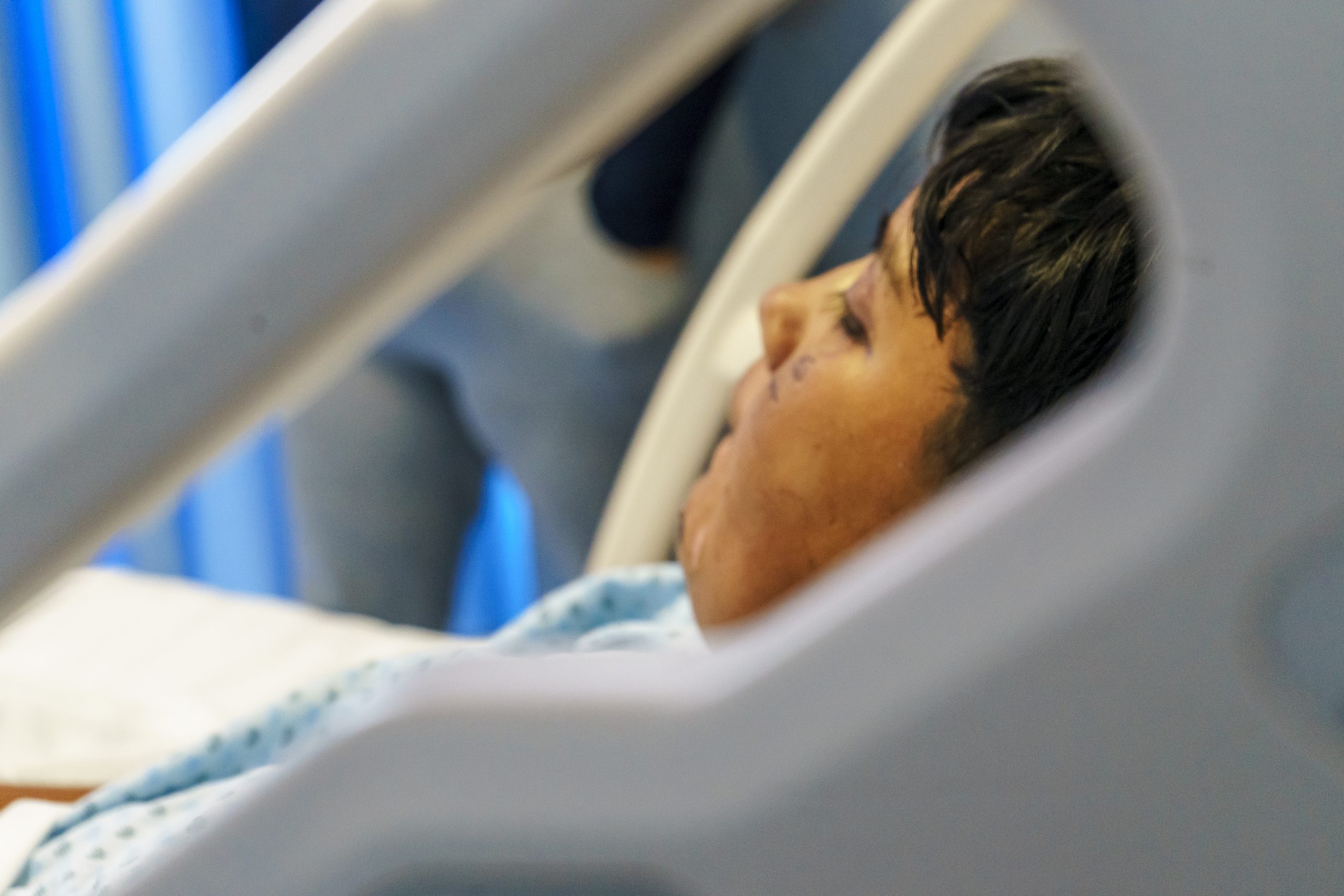 SSG hace un llamado a prevenir quemaduras por accidentes