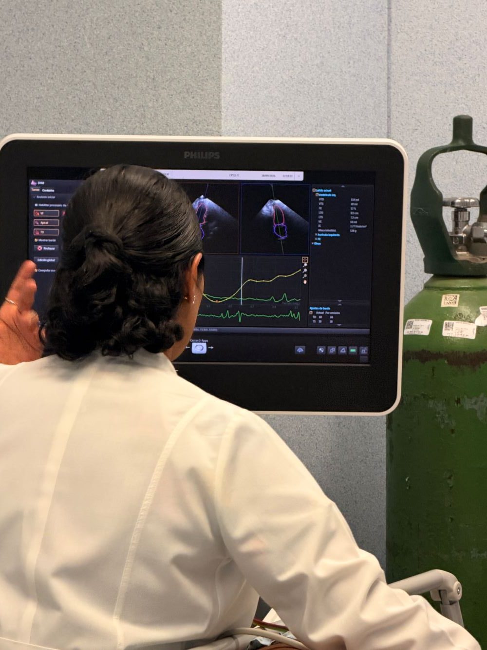 Guanajuato proyecta fortalecer la atención del cáncer con nueva Unidad de Radioterapia.